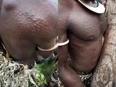 Here's a description of the image:The image shows the torso of a man from the Sepik River region, displaying intricate scarification patterns resembling crocodile skin, a cultural practice signifying initiation and identity.