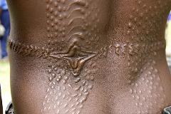 Close-up of a person's back showing traditional scarification patterns, including raised bumps and a star-shaped design, which may be related to rituals or cultural identity along the Sepik River.